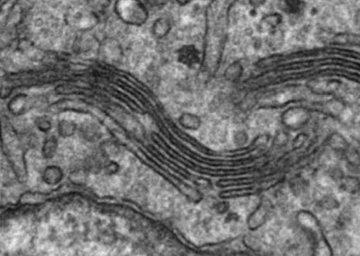 An electron micrograph of a Golgi stack (top). A stack of pancakes (bottom) depicts the unusual structure of the Golgi, which has fascinated Malhotra for two decades.