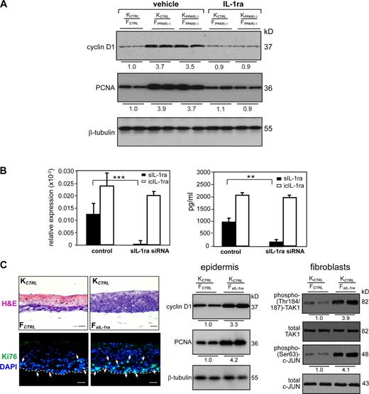 Figure 5. Reduced sIL-1ra in fibroblasts potentiates epidermal keratinocyte proliferation. (A) Immunoblot analysis of epidermis from indicated OTCs treated with either vehicle (PBS) or 50 ng/ml exogenous IL-1ra. Cell proliferation was measured using PCNA and cyclin D1. Values below each band were derived as described in Fig. 3 C. (B) Specific knockdown of sIL-1ra in human fibroblasts. (left) Knockdown efficiency was monitored by qPCR and normalized with control ribosomal protein P0. Specificity of knockdown was assessed by the relative expression level of icIL-1ra. (right) Protein expression of sIL-1ra and icIL-1ra as determined by ELISA. (C) Reduced fibroblasts sIL-1ra increase epidermal proliferation. OTCs were constructed using KCTRL with either control (FCTRL) or sIL-1ra knockdown (FsIL-1ra) fibroblasts. H&E, hematoxylin and eosin staining. (top) Ki67, cell proliferation (white arrows); DAPI, nuclear staining. Bars, 40 µm. (bottom) Bars, 20 µm. (left) Mean numbers of proliferating cells were derived as described in Fig. S1. Broken lines denote epidermal–dermal junction. (right) Immunoblot analysis of keratinocytes and fibroblasts extracted from two independent indicated OTCs. Equal amounts of total protein (50 µg) were resolved, electrotransferred, and probed for the indicated proteins. Values below each band represent the mean fold differences in expression level with respect to KCTRL or FCTRL extracted from KCTRL/FCTRL OTC. **, P < 0.01; ***, P < 0.001. Data are mean ± SD, n = 3.