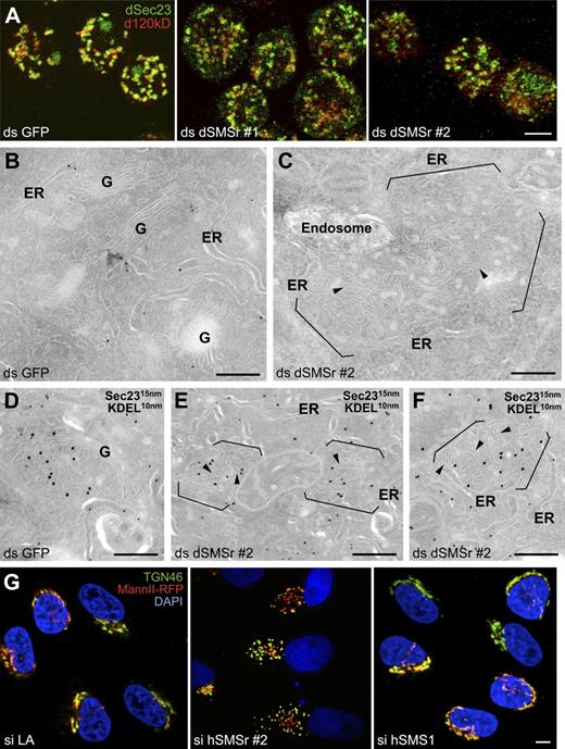 Figure 6. SMSr depletion disrupts tER–Golgi units in insect and mammalian cells. (A) S2 cells were treated for 7 d with ds GFP, ds dSMSr #1, or ds dSMSr #2 and double labeled for dSec23 (tER sites) and d120kd (Golgi stacks). Confocal projections of the merge are presented. The single channels are presented in Fig. S5 A. Bar, 5 µm. (B–F) S2 cells treated for 5 d with ds GFP (B and D) or dSMSr #2 (C, E, and F) were fixed and processed for immunoelectron microscopy. Ultrathin cryosections were visualized before (B and C) or after double labeling for dSec23 (15-nm gold) and KDEL (10-nm gold; D–F). Note that Golgi stacks in most dSMSr-depleted cells are converted to a cluster of short tubular profiles (arrowheads) in cytoplasmic regions normally occupied by tER–Golgi units (between brackets). These short tubules are positively labeled for Sec23, suggesting that they comprise membrane of both compartments. G, Golgi stack. (G) Mannosidase II-RFP–expressing HeLa cells were treated with si LA, si hSMSr #2, or hSMS1 for 3 d and labeled for TGN46 and DNA (DAPI). Confocal projections of the merge are presented. The single channels are presented in Fig. S5 (J–L). Bars: (A and G) 5 µm; (B–F) 200 nm.