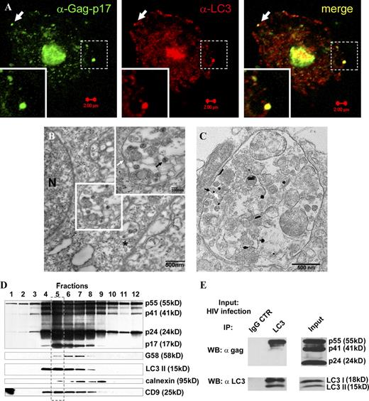 Figure 2. Autophagy protein LC3 colocalizes, copurifies, and coprecipitates with HIV Gag. (A) MDM were infected with VSV-G–pseudotyped HIV and immunostained for Gag-p17 and LC3. Arrows, a peripheral structure as an example of Gag-p17 and LC3 overlap. (B) Ultrastructural analysis of HIV virions in macrophages infected with HIV. U937 cells were infected with VSV-G–pseudotyped HIV. (inset) Enlarged region boxed in the electron micrograph. White arrow, membrane; black arrow, HIV virion; asterisk, HIV virions in a membranous compartment with a clathrin-coated pit consistent with plasma membrane origin. An enlarged image of this profile is shown in Fig. S1 C. (C) HIV-containing compartments are positive for LC3. Immunoelectron microscopy showing gold particles (enhanced gold particles appear globular, oval, and acicular) of LC3 in HIV-containing compartments. Arrow: virion and LC3 gold particle. See Fig. S1 D for p24 immunoelectron microscopy analysis. (D) HIV Gag precursor and Gag-derived proteins cofractionate with LC3 and the tetraspanin CD9. Subcellular organelle fractionation via isopycnic sucrose gradient separation was performed with lysates from HIV-infected cells (see Materials and methods). 12 fractions starting from the top were immunoblotted for the indicated proteins and organellar markers. The box with the broken line indicates peak band intensity fractions for LC3-II, Gag, and Gag-derived polypeptides, and CD9. (E) HIV Gag coimmunoprecipitates with LC3. U937 cells were infected with HIV and lysates immunoprecipitated for LC3. Immunoblotting with p24 and LC3 antibodies was performed on lysate and immunoprecipitate samples. The p24 antibody recognizes all three Gag proteins, as shown in the input. Note that only the precursor Gag-p55 comes down in immunoprecipitates with LC3 (n = 3).