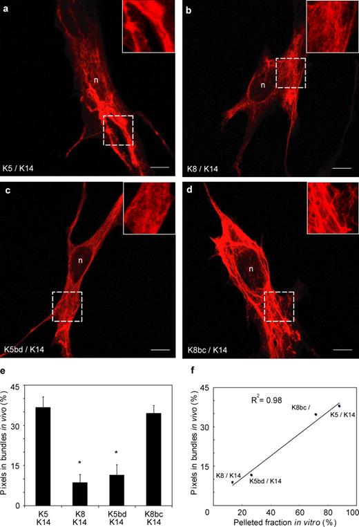 Figure 3. De novo keratin network formation in transfected BHK-21 fibroblasts. Bicistronic expression vectors including a GFP reporter and a type II keratin cDNA (K5, K8, K5bd, or K8bc) were individually cotransfected with a K14 expression vector into keratin-free baby hamster kidney fibroblasts (BHK-21). Cells were fixed and processed for analysis 72 h later. GFP fluorescence was used as an indicator of type II keratin expression. (a–d) Indirect immunofluorescence for K14 using confocal microscopy. The combinations transfected are given in the bottom left corners. The areas in the squares with broken lines are magnified in the upper right insets. n, nucleus. Bars, 10 µm. (e) Quantitation of the fluorescence signal specifically associated with large filament bundles in transfected cells. Image processing is detailed under Materials and methods and illustrated in Fig. S3. Each bar represents the mean and SEM (error bars) from 45 cells from three transfection experiments. *, significantly different from wild-type K5/K14; one-way ANOVA, P < 0.001. (f) Correlation between in vitro (pellet fraction in the low speed sedimentation assay; Fig. 2 B) and in vivo assembly behavior (bundle-associated fluorescence in transfected BHK-21 cells; Fig. 3E) for the K5/K14, K8/K14, K5bd/K14, and K8bc/K14 combinations.