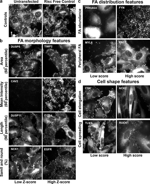 Figure 2. Summary of the effects of siRNAs on the analyzed features. Single images of representative sample wells, showing significantly high or low z scores in FA morphological features or significantly high or low manual scores in FA distribution or cell shape features. The images in the “Low Z-score” or “Low score” columns are those with significantly low z scores or manual scores, respectively. The images in the “High Z-score” or “High score” columns are those with significantly high z scores or manual scores, respectively. (a) Untransfected and Risc-free–transfected HeLa cells expressing YFP-paxillin (controls). (b) Examples of hits that varied widely from control cells in their FA morphological features: FA area, FA intensity, FA length, and small and round FAs. (c) Examples of hits that varied significantly from control cells in FA distribution features: FA abundance, and peripheral FA. (d) Examples of hits that varied significantly from control cells in cell shape features: cell elongation and cell spreading. The siRNAs are designated by their Entrez gene symbol (National Center for Biotechnology Information). For full information concerning the hits, see Table S2. Bar (applies to all images), 10 µm.