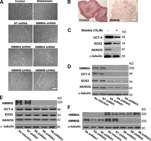 Figure 1. NMMIIA but not NMMIIB is necessary for multifaceted hESC functions. (A) Phase-contrast images of H9 cells cultured under feeder-free conditions with or without the following treatments: 10 µM blebbistatin (5 d), nontargeting shRNA (NT shRNA), NMMIIA, or NMMIIB shRNAs (4 d). (B) AP staining of H9 cells with or without 10 µM blebbistatin treatment (5 d). More images are shown in Fig. S1 A. (A and B) Bars, 100 µm. (C) Western blot analysis of OCT-4, SOX2, and NANOG proteins in H9 cells treated with or without 10 µM blebbistatin (5 d). A typical blot is shown, and quantification of blots from four separate experiments is shown in Table S1. α-Tubulin was a loading control. (D and E) Western blot analysis of NMMIIA/NMMIIB, OCT-4, SOX2, and NANOG proteins in H9 cells with or without NMMIIA/NMMIIB depletion (4 d). Three different shRNAs targeting NMMIIA (D) or NMMIIB (E) were used. Cells without lentiviral infection (no infection) or treated with nontargeting shRNA were used as negative controls. Quantifications of blots from four separate experiments for NMMIIA and NMMIIB depletion are shown in Table S1. Cells infected with nontargeting shRNA exhibited similar values to cells without infection. (F) Western blot analysis of NMMIIA or NMMIIB in H9 cells with NMMIIA or NMMIIB depletion, respectively.