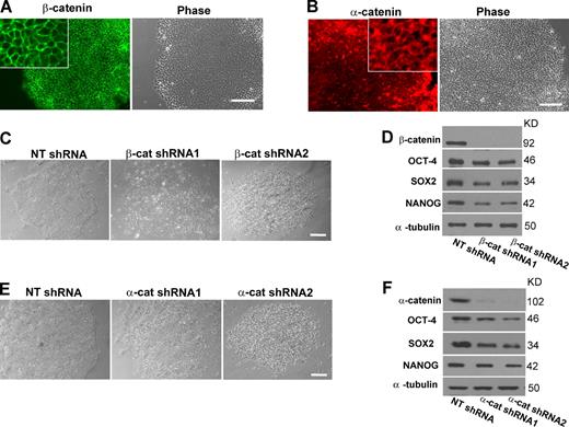 Figure 5. The effects of depleting α- and β-catenin on colony formation and pluripotency. (A and B) Immunofluorescence experiments of β-catenin (A) and α-catenin (B) in H9 cells. The corresponding phase-contrast images are also shown. The insets show fractions of fluorescence images at a higher magnification. (C) Phase-contrast images of H9 cells treated with nontargeting shRNA (NT shRNA) or shRNAs targeting β-catenin. (D) Western blot analysis of β-catenin, OCT-4, NANOG, and SOX2 proteins in H9 cells with or without 4-d depletion of β-catenin. (E) Phase-contrast images of H9 cells treated with nontargeting shRNA or shRNAs targeting α-catenin. (F) Western blot analysis of α-catenin, OCT-4, NANOG, and SOX2 proteins in H9 cells with or without 4-d depletion of α-catenin. (D and F) Quantification of the results is shown in Table S1. Bars, 100 µm.