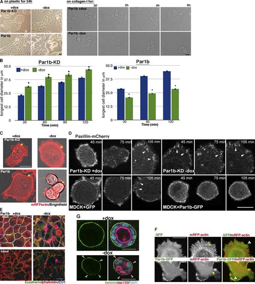Figure 1. Par1b inhibits cell spreading and stress fiber formation and promotes cell compaction. (A) Phase-contrast images of cell islands cultured on tissue culture plastic for 24 h (left) or brightfield images of a time lapse (Video 6) after cell plating on collagen I (right). Translucent holes in the 24-h Par1b (−dox) culture representing lateral lumina. (B) Spreading on collagen I. *, P < 0.001 for differences between ±dox. Error bars indicate SEM. (C, D, and F) Still images from time-lapse videos 30 (C and F) or 45 min (D) after plating on collagen. (C) Brightfield and mRFP fluorescence (Videos 1 and 2) are shown. Arrows point to stress fibers. (D) Note the dox-dependent size difference in Par1b cells and Paxillin-mCherry (Video 3). Arrowheads point to FAs. (F) GFP or Par1b-GFP and mRFP actin (Video 5) are shown. Note both the difference in stress fibers (arrows) and that Par1b-GFP but not GFP localizes to the tips of actin bundles in lamella (arrowheads). (E) Polarized Par1b cultures 24 h after Ca2+ switch. Phalloidin labels stress fibers at the basal domain (bottom) and microvilli-rich lateral lumina and apical domains in the maximum (max) projections (top; Video 6). (G) Confocal sections through collagen cysts of Par1b-MDCK cells (±dox; see Video 4 for full stacks). Arrowheads point to gaps in laminin. Also note that Par1b cysts are smaller than WT cysts (mean: 23 vs. 30 cells/cyst; n = 13/17). Bars: (A–F) 10 µm; (G) 25 µm.