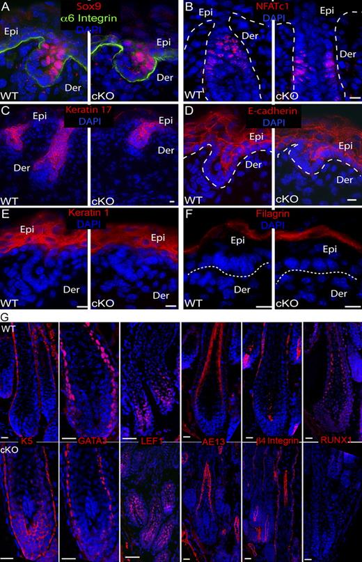 Figure 7. Normal expression of HFSCs and hair markers in Runx1 cKO. (A–F) Skin sections from WT and Runx1 cKO embryos at E16.5 immunostained for indicated markers. n = 3 WT and 3 cKO mice. Epi, epidermis; De, dermis. Bars, 10 µm. (G) PD6-9 skin sections from WT and Runx1 cKO littermates stained for indicated differentiation markers show normal expression. See Fig. S1 B for HF lineage reference. Bars, 10 µm.