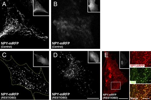 Figure 5. Transfected NPY-mRFP is expressed into DCVs only in astrocytes cotransfected with REST/DBD-GFP. The insets of all panels show the positivity of the cells for GFP (also positive for mRFP), documenting that they had been transfected with REST/DBD-GFP or the control construct. (A and B) In control cells, the distribution of NPY-mRFP is primarily in thin cisternae and few puncta (A, deconvolved image), which TIRF shows to be largely excluded from the surface layer of the cytoplasm illuminated by the evanescent wave (B). (C and E) In cells cotransfected with REST/DBD-GFP, NPY-mRFP is concentrated in scattered discrete puncta (C, deconvolved image) and colocalized with Sg2 (E, confocal image), corresponding, therefore, to the DCVs illustrated in Fig. 4 (D and E). The yellow line marks the contours of the cell. (D) Small NPY-positive puncta are abundant in the surface layer of the cytoplasm illuminated by the evanescent wave as illustrated by the TIRF image shown. The large fluorescent structures of E in the peri-Golgi area are accumulations of NPY-mRFP negative for Sg2 (not depicted; also see Fig. S2, E–H). The bottom box highlights the area of the three panels to the right showing the colocalization of NPY-mRFP and endogenous Sg2. A–E are representative of ≥10 cells produced in at least three transfection experiments. Bars: (A–E, left) 15 µm; (E, right) 5 µm.
