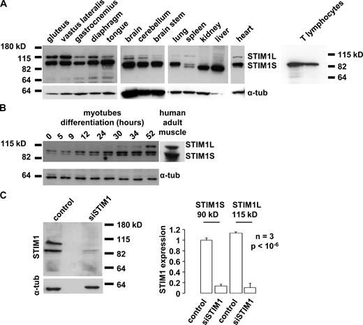 Figure 1. Identification of a new widely expressed STIM1 isoform. (A) Expression of STIM1 splice variants (N-terminal antibody) in adult mouse tissues and in T lymphocytes of two different patients. α-Tubulin (α-tub) was used for a loading control. (B) STIM1 expression during myoblast differentiation and in adult human skeletal muscle (N-terminal antibody). (C, left) STIM1 expression (N-terminal antibody) 96 h after transfection with a control siRNA (control) or with an siRNA that silenced both STIM1 isoforms (siSTIM1). (right) Quantification of STIM1 silencing efficiency (mean ± SD). STIM1 expression was normalized to control STIM1S levels and corrected for loading differences using α-tubulin (also see Fig. S1 A).