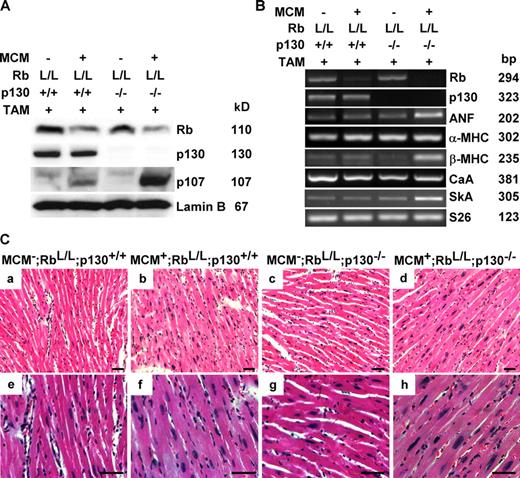 Figure 3. Creation of IDKO mice. (A) A Western blot using nuclear extracts prepared from ventricles of the indicated genotypes and demonstrating reductions in Rb protein levels after TAM treatment. (B) Expression of fetal cardiac-specific genes is up-regulated specifically in IDKO hearts. Semiquantitative RT-PCR was performed on total RNA extracted from purified ACMs with the indicated genotypes. For quantitation of changes in gene expression, see Fig. S3 A. CaA, cardiac actin; SkA, skeletal actin. (C) Hematoxylin and eosin staining of myocardial sections from mice with the indicated genotypes 1 wk after TAM treatment. Bars, 40 µm.