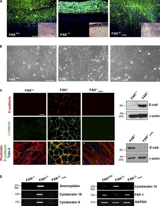Figure 1. FAK regulates the mesenchymal phenotype of MEFs. (A) CAM invasion by nanobeads (green) labeled FAK+/+, FAK−/−, and FAK-rescued FAK−/− (FAK−/−+FAK) embryonic cells. Cell invasion was visualized by fluorescence microscopy of CAM cross sections that were prepared after a 2-d incubation period. The CAM surface is marked by dashed lines. Quantification of invasion and the efficiency of FAK rescue are shown in Fig. S1. Hematoxylin and eosin–stained cross sections of CAMs are shown as insets. Results are representative of three experiments performed. (B) Phase-contrast images of FAK+/+, FAK−/−, and FAK-rescued null cells. (C) Confocal laser micrographs of E-cadherin (E-cad)–, β-catenin–, and phalloidin-stained cells (nuclei are stained with Toto-3). E-Cadherin protein levels in FAK+/+, FAK−/−, and FAK-rescued null embryonic cells by Western blot analysis. (D) RT-PCR analysis of desmoplakin and cytokeratins 18, 8, and 14 as well as FSP-1 mRNA levels in FAK+/+, FAK−/−, and FAK-rescued null MEFs. GAPDH, glyceraldehyde 3-phosphate dehydrogenase. Bars: (A and B) 100 µm; (C) 20 µm.