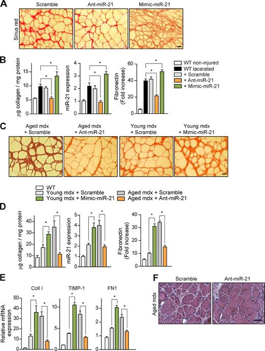 Figure 2. Efficacy of miR-21 silencing in preventing collagen accumulation after injury and treating muscular dystrophy by reversing fibrosis. (A) Prevention of fibrosis. TA muscles of WT mice were lacerated, and an antagomir for miR-21 (Ant-miR-21), a mimic for miR-21 (Mimic-miR-21), or Scramble oligomiR (Scramble; used as a negative control) was injected daily for 3 d starting at day 16 after laceration (before significant collagen deposition, which peaks at 21 d), and muscles were collected at day 21 after laceration. Sirius red staining on muscles of treated mice is shown. Bar, 25 µm. (B) Collagen protein accumulation and miR-21 expression were quantified in noninjured and 21-d lacerated muscles of WT mice; similarly, fibronectin was analyzed by immunofluorescence with a specific antibody (see representative panels in Fig. S1 E), and the positively stained areas were quantified by image analysis (*, P < 0.001; means ± SEM; n = 5 for each group). (C) Therapy for fibrosis. Sirius red staining of gastrocnemius muscle from 24-mo-old mdx mice (aged mdx) after administration of anti–mir-21 (or Scramble) every other day for 1 mo before collection of the muscles (left) and from 3-mo-old mice (young mdx) after administration of Mimic-miR-21 or Scramble with the same protocol (right) is shown. Bar, 25 µm. (D) As in B, collagen accumulation and miR-21 expression were quantified; similarly, fibronectin was analyzed by immunohistochemistry (see representative panels in Fig. S1 F) and quantified (*, P < 0.001; means ± SEM; n = 5 for each group). (E) The mRNA expression levels of Coll I, TIMP-1, and FN1 in the muscles of mice described in D are shown (*, P < 0.001 vs. WT mice; means ± SEM; n = 5 for each group). (F) H/E staining of gastrocnemius muscle sections from 24-mo-old mdx mice treated with Ant-miR-21 (or Scramble) for 1 mo. Bar, 50 µm.