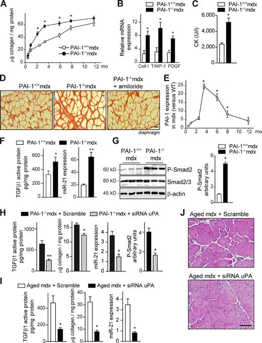 Figure 5. PAI-1 loss anticipates fibrosis and exacerbates muscle disease progression: Reversal by pharmacological and genetic interference with uPA in vivo. (A) Fibrosis quantification in diaphragms of PAI-1+/+ and PAI-1−/− mdx mice over time (*, P < 0.01 vs. age-matched PAI-1+/+ mdx; means ± SEM; n = 5 for each group). (B) Quantitative PCR analysis of fibrosis-associated markers in diaphragm muscles of 3-mo-old PAI-1+/+ and PAI-1−/− mdx mice (*, P < 0.05 vs. PAI-1+/+ mdx; means ± SEM; n = 5 for each group). (C) As in B, serum creatine kinase (CK) levels are shown (*, P < 0.01; means ± SEM; n = 5 for each group). (D) Representative Sirius red staining in diaphragm muscle sections of 3.5-mo-old PAI-1+/+ and PAI-1−/− mdx mice and PAI-1−/− mdx mice treated with amiloride (a uPA inhibitor; see Fig. S3 for additional information). Bar, 25 µm. (E) Quantitative PCR analysis of PAI-1 expression in diaphragm muscle of mdx mice at the indicated ages; values are expressed as fold induction over WT (*, P < 0.01 vs. 1 mo; means ± SEM; n = 5 for each group). (F) Increased TGF-β1 active protein and miR-21 expression in the diaphragm muscle of PAI-1−/− mdx mice compared with PAI-1+/+ mdx mice, as measured by ELISA and quantitative PCR, respectively (*, P < 0.05; **, P < 001, means ± SEM; n = 4 for each group). (G, left) As in F, muscle samples were analyzed by Western blotting using antibodies against the proteins P-Smad2, total Smad2/3, and β-actin. (right) Quantification of P-Smad2 versus total Smad2/3 and normalized for β-actin levels is shown (*, P < 0.01; means ± SEM; n = 5 for each group). P-Smad2 levels in basal muscle of WT and PAI-1−/− mice were undistinguishable (not depicted). (H) siRNA for uPA or a scrambled control oligomiR was delivered into gastrocnemius muscles of 3-mo-old PAI-1−/− mdx mice every other day for 3 wk, and, after the treatment, muscles were analyzed for TGF-β1 active protein levels, collagen content, miR-21 expression, and Smad2 activity (P-Smad2; *, P < 0.05; **, P < 001, means ± SEM; n = 4 for each group). (I) siRNA for uPA or Scramble was delivered into the gastrocnemius muscle of 24-mo-old mdx mice every other day for an additional 1 mo. Then, muscles were analyzed for TGF-β1 activity, collagen content, and miR-21 expression (*, P < 0.01; means ± SEM; n = 5 for each group). (J) As in I, H/E staining is shown. Bar, 50 µm.