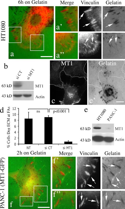 Figure 1. MT1-MMP mediates ECM degradation at focal adhesions. (a) To test if extracellular matrix degradation occurs at focal adhesions, HT-1080 cells were plated on fluorescent gelatin (green)-coated coverslips for 6 h before fixation and staining with a vinculin antibody (red). Matrix degradation occurred at vinculin-positive FA sites. Boxed regions provide a higher magnification showing the correlation between vinculin and matrix degradation in the gelatin matrix (dark spots in a’ and a’’). (b–c’) To define if MT1-MMP is required for the FA-centered degradation, HT-1080 cells were treated with MT1 siRNA for 72 h to knock down endogenous MT1-MMP (b), and then were plated on gelatin-coated coverslips (c and c’). MT1 knockdown cells (dashed lines) exhibit a significant reduction in matrix degradation. (d) Quantification of the percentage of cells (in c) that degraded ECM at FAs indicates that MT1 is required for this type of degradation. Values represent the mean of three independent experiments ± SD. (e and f) In reciprocal experiments MT1-MMP was overexpressed in a human pancreatic tumor cell line (PANC-1) that does not express endogenous MTI-MMP (e) or degrade matrix (Fig. S2). Just 2 h after plating on gelatin the transfected PANC-1 cells exhibited substantial matrix degradation at FA sites (f–f’’). Additional examples of pancreatic tumor cells degrading matrix at FAs are provided in Fig. S1. Bars, 10 µm.