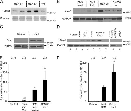 Figure 1. Staufen1 expression is specifically increased in DM1. (A) Western blot of muscle protein extracts showing increased Staufen1 (Stau1) in tissues from HSA-LR mice compared with HSA-SR and WT controls. Anti-Staufen1 antibody (Bélanger et al., 2003) was used. Ponceau staining was used to show equal loading. (B) Western blot of muscle protein extracts, using a different Staufen1 antibody (Abcam), showing increased Staufen1 in DM5 induced (ind.) mice, DM200 induced mice, and HSA-LR mice compared with uninduced DM5 mouse controls. (C) Western blot of protein extracts from muscle biopsies showing increased Staufen1 in DM1 patients in comparison with control individuals (anti-Staufen1; Abcam). (D) Western blot showing increased Staufen1 in muscle biopsies from additional DM1 patients compared with control biopsies and biopsies from other muscle dystrophies (anti-Staufen1; Abcam; Table S1). (E and F) Quantification of Staufen1 level in DM1 mouse models (E) and in human DM1 biopsies (F). As Staufen1 is not detected in control samples, Staufen1 levels are expressed over background. All samples from C and D were included in the quantification in F. Data are means ± SEM. **, P < 0.01; ***, P < 0.001 (Student’s t test).