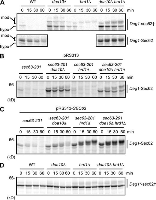 Figure 4. Inhibiting Deg1-Sec62 association with the translocon delays its PTM and restores Doa10-dependent degradation. (A–D) Pulse-chase analysis of Deg1-Sec62 variants in the indicated yeast strains. Where noted, yeast harbor a plasmid encoding WT Sec63 or an empty vector. Deg1 fusions in A and D were precipitated with anti-Deg1 antibodies. Deg1 fusions in B and C were chased in the presence of cycloheximide and precipitated with anti-Flag antibodies. Molecular weight markers for the autoradiograph in A are not available; however, migration of the same protein can be seen in Fig. S1 D. sec62†, G127D of Deg1-Sec62, equivalent to G37D of untagged Sec62. sec63-201, 27-residue C-terminal truncation of Sec63. Deg1*, F18S/I22T double mutant.