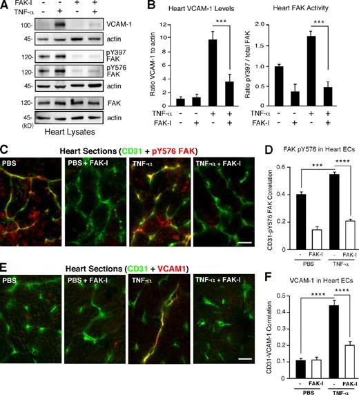 Figure 1. TNF-α–induced VCAM-1 expression within heart-associated ECs in vivo is dependent on FAK activity. PBS or TNF-α (0.02 mg/kg) was tail vein injected into mice, and, after 6 h, tissues were analyzed by immunoblotting or staining. Where indicated, FAK-I (100 mg/kg, PND-1186) was administered 3 h before starting experiments. (A) Immunoblotting of heart lysates shows increased VCAM-1 expression and FAK Y397 or FAK Y576 phosphorylation upon TNF-α stimulation in vivo. FAK-I addition prevents VCAM-1 production and FAK tyrosine phosphorylation but no change in FAK expression. Internal loading controls for each gel are shown by anti-actin immunoblotting. (B) Heart-associated VCAM-1 or FAK activation (pY397) was determined by immunoblotting (see Fig. S1) and expressed as a ratio to actin or total FAK, as determined by densitometry, respectively. Values are means (±SD) from six mice, representing two independent experiments (***, P < 0.001). (C) In vivo signaling assays were performed as in A, and heart sections were analyzed by combined staining for activated FAK (pY576) and ECs (CD31). Bar, 20 µm. (D) Mean correlation of pixel intensities from anti–pY576 FAK and anti-CD31 staining of heart sections, as shown in C. (E) Visualization of EC-associated VCAM-1 expression. Heart sections were analyzed by combined staining for VCAM-1 and ECs (CD31). A merged image is shown. Bar, 20 µm. (F) Mean correlation of pixel intensities from anti–VCAM-1 and anti-CD31 staining of heart sections, as shown in C. (D and F) 10 full-frame images were analyzed per experimental group for calculations of VCAM-1 and pY576 FAK associated with CD31 staining (±SEM; ***, P < 0.001; ****, P < 0.0001).
