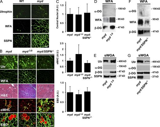 Figure 6. SSPN regulates utrophin levels and glycosylation of α-DG in myd mice. (A) Transverse cryosections of quadriceps muscles were stained with the indicated antibodies and overlayed with biotinylated WFA. (B) Transverse cryosections of quadriceps muscles were stained with indicated antibodies and overlayed with biotinylated WFA. Staining with IIH6 antibodies, which recognize LARGE epitopes on α-DG, was not detected in myd samples, as expected (Fig. S4). Transverse cryosections of skeletal muscle from 4–6-wk-old myd, SSPN-Tg:myd (myd 3.0), and SSPN-deficient myd (myd:SSPN−/−) mice were stained with H&E. Muscle sections were stained with antibodies to embryonic myosin heavy chain (eMHC; green) as a marker for newly regenerated myofibers. Mice were injected with Evans blue dye (EBD), a marker for membrane instability (visualized by red fluorescence). Sections were costained with laminin antibodies (green fluorescence) to visualize individual fibers. (C) Quantification of central nucleation, Evans blue dye–positive fibers, and eMHC-positive fibers is expressed as a percentage of total fibers. Error bars represent standard deviation of the mean (n = 4 quadriceps per genotype). (D–G) Skeletal muscles from the indicated mice were enriched using either sWGA or WFA lectin chromatography. Immunoblots of 10-µg protein eluates are shown. A.U., arbitrary unit; Utr, utrophin. Bars, 50 µm.
