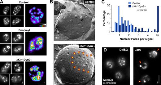 Figure 4. Clustering of nuclear pores occurs in the absence of microtubules and in kinesin-1/dynein double mutants. (A) Nup133-GFP–labeled nuclear pores in DMSO-treated cells (Control), cells treated with the microtubule inhibitor benomyl (30–60 min), and kinesin/dynein double mutants (ΔKin1Dyn2↓). In control cells the pores are evenly distributed within the nuclear envelope, whereas they aggregate in the absence of microtubules or in motor mutants. Aggregation is best seen in false-colored images that show signal intensity in a color code (right panels). Images were subject to adjustment in brightness, contrast, and gamma settings. Bars represent micrometers. (B) Freeze-fracture electron micrograph showing clustering of nuclear pores in kinesin/dynein double mutants (ΔKin1Dyn2↓). Arrowheads mark a NPC cluster. Bars represent micrometers. (C) Bar chart showing the distribution Nup133-GFP fluorescent intensity in Nup133-GFP signals as an estimate of nuclear pore numbers. Total number of analyzed signals is 109 (Control) and 108 (ΔKin1Dyn2↓) from a single experiment. NPC clustering was confirmed in three independent experimental repeats. Note that all measurements were done in top-views of the upper focal plane of the nuclei. (D) Distribution of nuclear pores (labeled with GFP-Nup82) in the budding yeast Saccharomyces cerevisiae after 30 min treatment with the solvent DMSO and 10 µM of the actin inhibitor latrunculin A (LatA). NPCs form clusters (arrowheads). Note that NPC motility is also impaired (see Fig. S3). Images were subject to adjustment in brightness, contrast, and gamma settings. Bar represents micrometers.