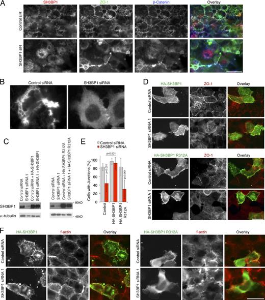 Figure 6. The GAP activity of SH3BP1 is required for junction formation. (A) A431 cells were transfected with siRNAs, serum starved, and then stimulated with EGF for 5 min. After fixation, the cells were stained as indicated. Shown are epifluorescence images from the dorsal aspect of the cells. Note that A431 dorsal ruffles are positive for SH3BP1, β-catenin, and ZO-1, which are disrupted upon SH3BP1 depletion. (B) GFP-actin–expressing A431 cells were transfected with siRNAs, serum starved, and then stimulated with EGF. Shown are images of time-lapse recordings taken from the dorsal aspect of the cells. See also Videos 1, 2, 3, and 4. (C–F) A431 cells were transfected with the indicated siRNAs and, after 3 d, with RNAi-resistant cDNAs encoding HA-tagged wild-type or GAP-deficient SH3BP1. The cells were serum depleted, stimulated with EGF, and then analyzed by immunoblotting (C) and immunofluorescence (D–F). E shows a quantification of cells with junctional ZO-1 staining. Shown are means ± 1 SD, representing the cells in at least seven different fields per condition (n ≥ 7). Note that mutant SH3BP1 has a strong dominant-negative effect on the actin organization. Bars: (A, D, and F) 10 µm; (B) 5 µm.