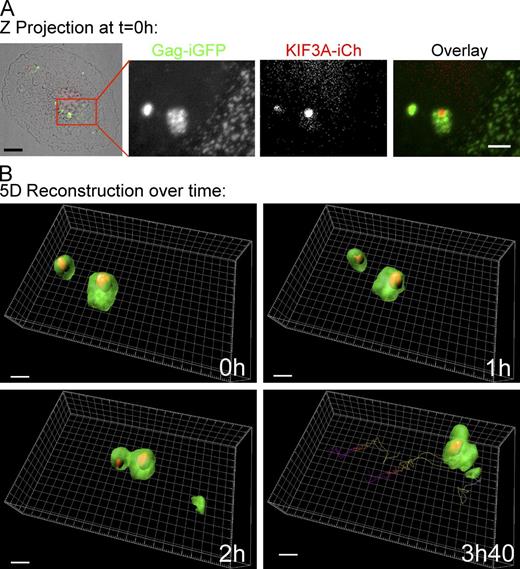 Figure 7. Dynamics of internally tagged forms of KIF3A and Gag in primary macrophages. General view of a macrophage coinfected with HIV-1 Gag-iGFP ΔEnv and KIF3A-iCherry lentiviral vector and cultured for 5 d. The cell was imaged for 5 h by spinning disc microscopy. (A) Z-projection of the overlaid transmission, GFP and mCherry fluorescent intensities at time 0 (left, bar, 5 µm). The red square region is magnified for GFP and mCherry channels and the overlay of the two (panels 2–4; bar, 2 µm). Time 0, 1, 2, and 3 h 40 of a 3D reconstruction of the boxed area are presented with the tracking of the VCCs visible on the 3 h 40 panel (see Videos 3 and 4). Bar, 2 µm.