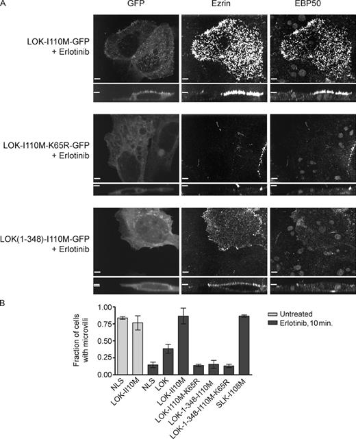 Figure 7. Regulated LOK activity is necessary and sufficient for microvilli in the presence of erlotinib. (A) Cells expressing erlotinib-resistant mutants of LOK as indicated were treated with 20 µM erlotinib for 10 min. LOK-I110M-GFP–transfected cells (or SLK-I108M-GFP–transfected cells; Fig. S4, B and C), but not neighboring untransfected cells, are protected from microvillus loss caused by erlotinib. Cells transfected with LOK-1–348-I110M-GFP have membrane-enriched depolarized ezrin but do not form microvilli. (B) Microvilli scoring of EBP50-stained Jeg-3 cells transfected with the indicated GFP-tagged protein or GFP-NLS as indicated and then treated with or without erlotinib. Data are means ± SD of three independent experiments. Bars, 10 µm.