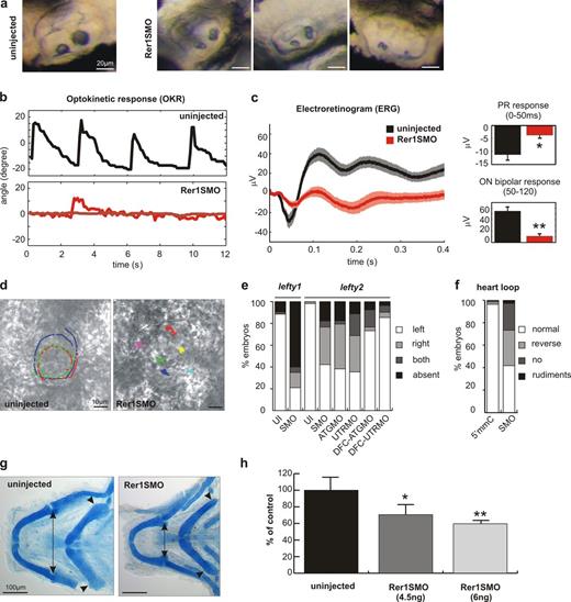 Figure 2. Functional impairment of the ciliated organs in Rer1p morphant embryos. (a) Defective otolith formation in the inner ear of SMO. (b) Reduced or absent optokinetic response of 4.5-dpf SMO. The relative angle of eye rotation is shown for a control and two SMO larvae (n > 10). (c) Impaired retinal activity as measured by ERG in 4.5-dpf SMO; mean ± SEM is represented by shading. Decreased photoreceptor (PR) response and concomitant ON bipolar response (n ≥ 16). (d) Directional fluid flow in the KV is absent in the SMO as shown by fluorescent bead tracking (see Videos 3 and 4). Colored tracks show individual bead movements. (e) Randomization or loss of expression of Nodal antagonists lefty1 and lefty2 in SMO, ATGMO, and UTRMO as well as in DFC-specific injection of ATGMO and UTRMO at 20 hpf. Bars indicate percentages of embryos with expression on either side, both sides, or absent (n ≥ 90). UI, uninjected. (f) Reversal or absence of heart looping in SMO at 48 hpf. Bars indicate percentages of normal, reverse, or no heart looping. (g) Dorsal view of Alcian-stained cartilage of zebrafish heads. Arrowheads point to changes in pharyngeal cartilage chondrocyte number/arrangement; morphometric differences indicated by arrows are quantified in h. Means ± SEM (c) or SD (h); *, P < 0.05; **, P < 0.01, Wilcoxon rank sum test (c) or Student’s t test (h).