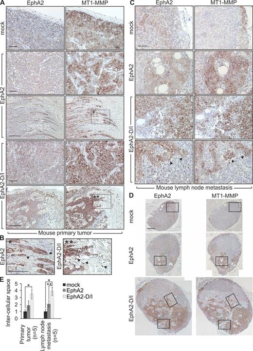 Figure 8. EphA2 cleavage promotes single cell phenotype of MDA-MB-231 cells in vivo. Control, EphA2, or EphA2-D/I stably expressing MDA-MB-231 cells were orthotopically injected into the mammary fat pad of SCID mice. Tumor growth was followed for 4 wk. Tumor sizes were not significantly different (mock, 567 ± 96.25 mm3; EphA2, 320 ± 145.75 mm3; EphA2-D/I, 601 ± 81.43 mm3). (A and B) EphA2 and MT1-MMP immunohistochemistry of paraffin sections of the primary xenograft tumors. Corresponding areas (A, boxed regions) and the magnified insets (B) are marked with single and double asterisks. Arrowheads indicate invasive front cells. (C and D) Immunohistochemistry of representative metastatic tumor cell colonies in lymph nodes. The broken lines demarcate the border between tumor cells and host tissue. Arrowheads indicate singly invading cells with high MT1-MMP and intracellular EphA2. Boxes (D) indicate the areas magnified in the insets (C). Bars: (A–C) 50 µm; (D) 200 µm. (E) Quantitative assessment of intercellular spaces within tumor cell colonies in mouse primary tumors and lymph nodes (error bars indicate mean ± SEM). The measured example areas are shown in Fig. S3 G. Relative intercellular space of the mock tumors is set to one. *, P < 0.01, **, P < 0.05; Mann–Whitney U test.