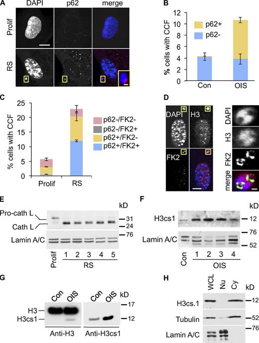 Figure 4. Cytoplasmic histone is processed by a lysosomal/autophagy pathway. (A) Close juxtaposition of senescence-associated CCF (RS) with p62 nuclear bodies. Bars: 10 µm; (inset) 1 µm. (B) Quantitation of control and OIS cells with CCF overlapping p62 (p62+) or not (p62−). Mean ± SEM, n = 3. (C) Quantitation of proliferating and RS cells with CCF overlapping p62 (p62+) or not (p62−) and protein ubiquitination (FK2+) or not (FK2−). Mean ± SEM, n = 3; P < 0.0008 for FK2+/p62+ CCF, comparing proliferating and RS cells. (D) Ubiquitinated proteins appear to line chromatin surface in CCF. Yellow boxed areas are magnified in right-hand panels. Bars: (left panels) 10 µm; (right panels) 1 µm. (E) Apparent activation of cathepsin L in RS IMR90 cells. In contrast to RS cells, the majority of cathepsin L in proliferating control cells exists in its inactive pro-cathepsin L form. Loading was normalized by cell number and lamin A/C was used as a loading control. See Materials and methods for details of time course. (F) Accumulation of H3cs.1, a specific N-terminal cleavage product of H3, in OIS cells. See Materials and methods for details of time course. Western blotting was performed using the same cellular lysates as in Fig. S4 B, and the same lamin A/C panel is shown in both figures. (G) Accumulation of H3cs.1 and corresponding high mobility H3 in OIS. (H) Predominant cytoplasmic localization of H3cs.1 in senescent cells. α-Tubulin and lamin A/C were used as fractionation controls for cytoplasmic and nuclear fractions, respectively.
