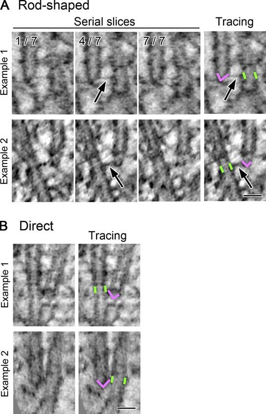 Figure 2. Ultrastructure of the augmin-dependent end-links that connect two adjacent MTs. Two types of connection between an MT closed (minus) end and the lattice of an adjacent MT. (A) Selected tomographic slices (1.4 nm/slice; three out of seven serial slices) of two end-lattice connections, at which rod-shaped end-links were detected (arrows). Note that the links are most clearly visible in the fourth plane, which includes the daughter MT end. Manual tracings of the mother MT wall (green; a part of the wall lying in this slice was marked) and the capped daughter MT ends (magenta) are displayed on the right. See Videos 1, 2, and 3 for more serially sliced or rotated images. (B) Two examples of the direct end-link. See Fig. S3 for more images. Bars, 30 nm.