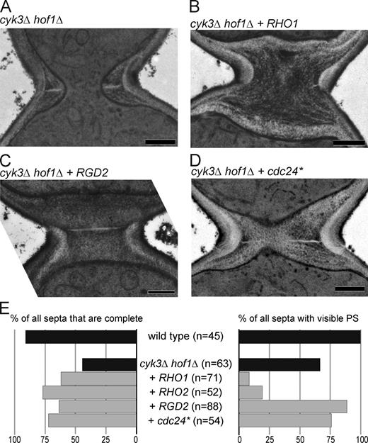 Figure 3. Thickened SS without restoration of PS when Rho-related genes are expressed in cyk3Δ hof1Δ cells. (A–D) cyk3Δ hof1Δ strains overexpressing the indicated genes (Fig. 2 A) were streaked on SC + 5-FOA plates to eliminate the URA3-marked HOF1 plasmid and observed by EM. (A) RNY2127, (B) MOY245, (C) MOY682, and (D) MOY78. Bars, 0.5 µm. (E) For each strain, cells with any visible septal structure were scored for successful bud-neck closure (left) and the presence of PS-like structures (right). Data for RHO2 are from the experiment in Fig. S3 A Black bars show control strains without plasmid. Gray bars show mutant strains transformed with plasmids overexpressing the indicated genes.