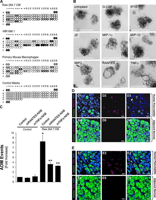 Figure 3. Macrophage-secreted factors RANTES and TNF mediate ADM. (A) Conditioned media from Raw 264.7, WR19M.1, activated primary mouse macrophages, or control media (bottom) were subjected to a mouse cytokine profiler array allowing the detection of 40 different cytokines (see table in Fig. S3 A for cytokine identity and position on the array; A1/2, A23/24, and F1/2 contain positive controls, and F23/F24 contains negative controls). (B) Mouse primary acinar cells were co-cultured in 3D collagen explant culture in the presence of the cytokines (G-CSF, IP-10, JE, MIP-1α, MIP-1β, MIP2, RANTES, or TNF; all at 50 ng/ml) that were specifically identified in conditioned media from macrophages. Shown is a representative picture of each condition showing either acinar or ADM clusters. (C) Primary mouse pancreatic acinar cells were isolated and treated with Raw 264.7–conditioned media to induce ADM in the presence of neutralizing antibodies (NAB) for 0.5 µg/ml mRANTES and 3 µg/ml mTNF-α as indicated. At day 5, ADM events per well were quantified by counting. The single asterisk indicates statistical significance as compared with control determined by the Student’s t test. Double asterisks indicate statistical significance as compared with control and as compared with Raw 264.7–conditioned medium–induced ADM as determined by the Student’s t test. Bar graph shows means ± SD of n = 3 experiments. (D) Immunofluorescence staining of amylase, RANTES, and DAPI in human pancreas tissues containing a pancreatitis-affected area (top row) and adjacent normal area (bottom row). (left, D1 and D4) Amylase + DAPI; (middle, D2 and D5) RANTES; (right, D3 and D6) merged images containing amylase, DAPI, and RANTES. (E) Immunofluorescence staining of amylase, TNF, and DAPI in human pancreas tissues containing areas affected by pancreatitis (top row) or adjacent normal area (bottom row). (left, E1 and E4) Amylase + DAPI; (middle, E2 and E5) TNF; (right, E3 and E6) merged images containing amylase, TNF, and DAPI. See also Fig. S3 B. All experiments depicted have been repeated with similar results at least three times. Bars: (B) 200 µm; (D and E) 20 µm.