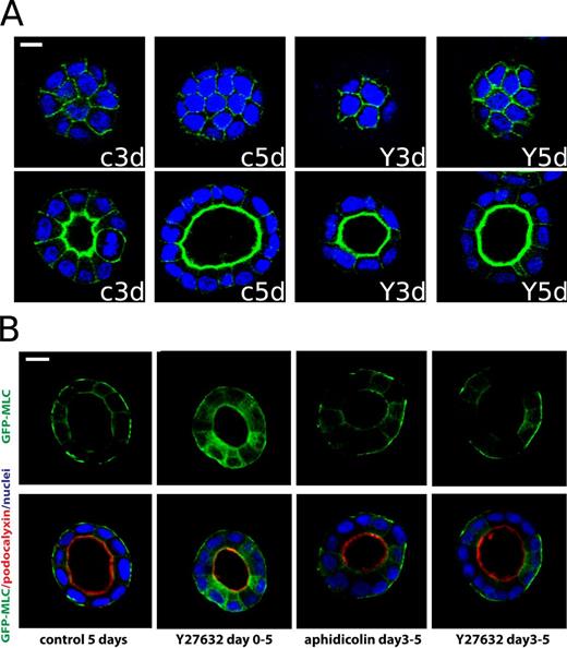 Figure 4. ROCK inhibition alters the cellular spatial distribution of MLC. (A) Representative micrographs of top (top) and mid sections (bottom) of cysts fixed at days 3 and 5 grown under no treatment (c3d and c5d) and treated with Y-27632 (Y3d and Y5d). Cysts were stained with DAPI and phalloidin. Bar, 10 µm. (B) We used GFP-MLC as an indicator for cortical tension (Yu et al., 2003). MDCK cells expressing GFP-MLC were cultured in Matrigel solution. Aphidicolin and Y-27632 were applied separately from day 0 or day 3. Cells were then fixed at day 5 and stained for PCX and nuclei. In control cysts, MLC is concentrated at the basal surface in an untreated cyst. When Y-27632 is applied from day 0, MLC is no longer accumulated at the basal surface, and instead is diffuse in the cytoplasm. In contrast, Aphidicolin does not change the localization pattern of MLC, which remains mainly at the basal surface. For a more detailed quantification of this effect see Fig. S5. Bar, 20 µm.