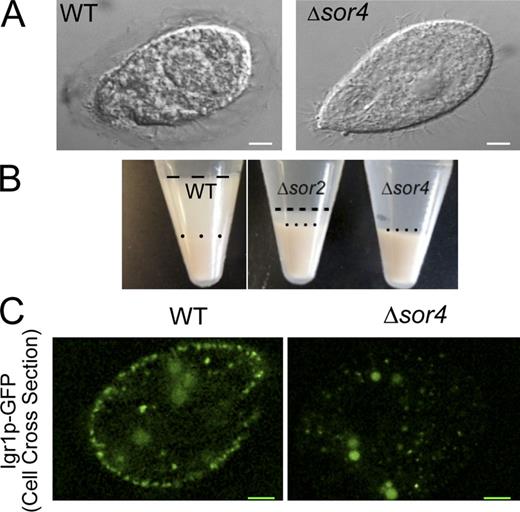Figure 4. Δsor4 cells are defective in regulated exocytosis and in sorting of a second Grt family protein. (A) A qualitative assay for mucocyst discharge. Individual T. thermophila cells, fixed and photographed after treatment with the secretagogue Alcian blue. The wild-type cell (left) is surrounded by a translucent capsule made up of the released contents of exocytosed mucocysts. In contrast, Δsor4 cells (right) never form visible capsules after stimulation. Images are differential interference contrast micrographs. The same wild-type control is shown again in Fig. S4 A. Bars, 5 µm. (B) A semiquantitative assay for mucocyst discharge. Identical numbers of wild-type and Δsor4 cells were stimulated with dibucaine, and immediately centrifuged. The wild-type culture produces a two-layer pellet, in which a thick layer of flocculent (below the broken line) resulting from mucocyst discharge sits atop of the packed cells (below the dotted line). Stimulated Δsor4 cultures, in contrast, produce no flocculent layer. Stimulated Δsor2 cultures generate an intermediate amount of the mucocyst-derived flocculent. (C) Δsor4 cells show defective sorting to mucocysts of a second Grt family protein, Igr1p. Igr1p-GFP, expressed from an inducible promoter, accumulates in docked mucocysts in wild-type cells (left), but is absent from the periphery of Δsor4, instead found in small highly mobile cytoplasmic puncta. Images are of GFP autofluorescence in live, immobilized cells. Bars, 5 µm.
