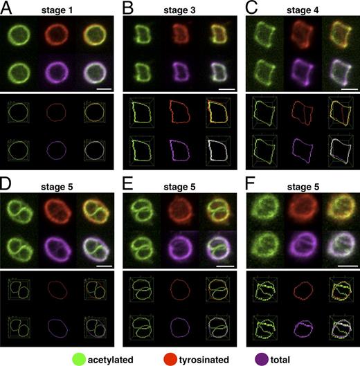 Figure 4. Newly polymerizing microtubules form a smaller microtubule ring in activated platelets. (A–F) Platelets with MBs at different coiling stages were triple immunostained for acetylated α-tubulin, tyrosinated α-tubulin, and total α-tubulin. Individual stainings as well as merges of 3D reconstructions of confocal z stacks are shown in the top images. The bottom images are generated from the different stainings after thresholding and skeletonizing of the MBs. For further details, see the legends of Videos 8 and 9. Bars, 2 µm.