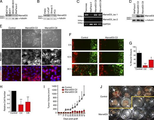 Figure 2. MarvelD3 regulates cell migration and proliferation of MiaPaca-2 cells. (A and B) Immunoblotting of extracts of cell lines derived from breast and pancreas (A) and prostate (B). (C) RT-PCR analysis of MarvelD3 isoform expression in healthy adult pancreas, and control and MarvelD3 isoform 1–transfected MiaPaca-2 cells. (D) Immunoblotting of control and MarvelD3 isoform 1–transfected MiaPaca-2 cells. (E) Morphology of control and MarvelD3-expressing MiaPaca-2 cells (two clones, C2 and C8, were analyzed in all experiments) was assessed by phase-contrast and immunofluorescence microscopy (see Fig. S2 for analysis of other junctional markers). (F and G) Migration assays were performed with GFP- and RFP-expressing pools of control and MarvelD3-expressing MiaPaca-2 cells over 2 d. The quantification was performed, and images were taken after 24 h and show means ± 1 SD; n = 3. Note, only control cells freely mix after they have filled the gap or when labeled cells are co-cultured (see Fig. S2 C for co-cultures). (H) Proliferation of control and MarvelD3-expressing cells was analyzed by measuring cell numbers after 3 d (shown are means ± 1 SD; n = 3). (I and J) Nude mice were injected with control or MarvelD3-expressing MiaPaca-2 cells, and tumor formation was assessed by measuring the size over 47 d. Shown are means ± 1 SD of five animals per cell line. *, P < 0.05; **, P < 0.01. Bars: (E, top) 50 µm; (E, bottom) 20 µm; (F) 100 µm.