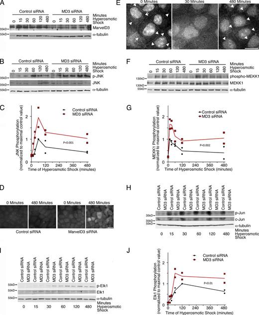 Figure 8. MarvelD3 and the MEKK1–JNK pathway during osmotic stress. (A–J) Caco-2 cells were transfected with control and MarvelD3 siRNAs and were then osmotically stressed for the times indicated before analysis by immunoblotting (A–C and F–J), staining for phospho-Jnk (p-JNK; D) or with mouse anti-MEKK1 antibodies (E). Arrowheads in E mark cell–cell contacts positive for MEKK1. The graphs in C, G, and J show individual determinations, and the lines were drawn through the corresponding means for each time point. See Fig. S4 for specificity controls for the MEKK1 staining and quantification of junction-associated MEKK1. Bars: (D) 20 µm; (E) 10 µm.