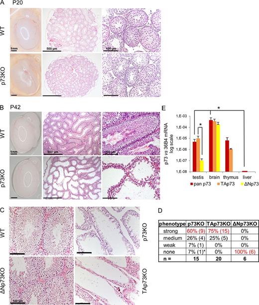 Figure 1. TAp73 deficiency causes a profound absence of developing and mature germ cells from the seminiferous epithelium. (A and B) Testis histology from p73KO and WT littermates at ages P20 (A) and P42 (B). H&E staining was used. Sexually mature 6-wk-old p73KO mice (B) show severe loss of developing germ cells and mature spermatozoa, creating “nearly empty” seminiferous tubules. Some variability in severity from tubule-to-tubule in a given KO mouse or among different mice was noted. (A and B, left) Whole testis with epididymis. (C) Testis histology from adult WT, p73KO, and isoform-specific ΔNp73KO and TAp73KO mice of similar age (7–10 wk). H&E staining was used. TAp73KO mice phenocopy global p73KO mice, whereas ΔNp73 deficiency does not affect testis morphology. (D) Severity of the testicular phenotype. Shown is a summary of all analyzed mice (6–10 wk) assessed by scoring H&E sections. p73KO (86%) and TAp73KO (100%) mice show medium-to-strong loss of developing and mature germ cells and a flat germ epithelium. In contrast, all ΔNp73KO mice have normal morphology. Asterisk: compared with its littermates, this 6-wk-old p73KO animal had small testis, which indicated delayed development. (E) p73 mRNA levels in different organs of 6–10-wk-old WT mice. qRT-PCR of all (pan) or TA/ΔN-specific isoforms was performed. TAp73 is the predominant isoform in testis (>100-fold higher than ΔNp73). n = 2–3 per organ, mean ± SD (error bars). *, P < 0.05 (t test). See also Fig. S1.