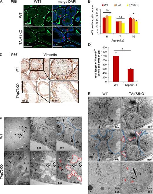 Figure 4. Sertoli cell morphology is degenerate in TAp73KO mice. (A and B) The number of Sertoli cells is normal in KO mice. Immunofluorescence analysis (A) and quantitation (B) of testis of adult TAp73KO and WT/Het mice of different ages for WT1, a nuclear Sertoli cell marker (arrowheads), is shown. Interstitial Leydig cells show unspecific staining. n = 2–5 mice/genotype, mean ± SD (error bars). ns, not significant. *, P < 0.05 (t test). (C and D) KO Sertoli cells have abnormally short and thin cytoplasmic arms. (C) Immunostaining of testis of adult TAp73KO and WT mice for Vimentin, an intermediate filament Sertoli cell marker. (D) Quantitation. The lengths of all cytoplasmic arms within a field of view reaching from the basal lamina up to the lumen were added (total length of Vimentin + Sertoli cell arms). n = 3 mice/genotype. Results are the mean ± SD (error bars) of five fields. *, P < 0.005 (t test). (E and F) Electron microscopy of adult testis of TAp73KO and WT mice. (E) KO Sertoli cells (S, outlined in blue) have abnormally thin cytoplasmic arms, high vacuolization (arrows), and poor adherence to neighboring germ cells (large lacunar gaps, outlined in red). WT Sertoli cytoplasmic arms are broad and tightly wrapped around germ cells (SC). In contrast, KO Sertoli cells show degenerate morphology. (F) In KO seminiferous epithelium, germ cells are very loosely packed and Sertoli cells fail to envelope and retain the developing gametes. Gaps and holes are marked in red. Arrows indicate elongated spermatids aberrantly close to the basal lamina. In contrast, WT epithelium is firmly packed with germ cells (SC) attaching very tightly to their Sertoli nurse cell (S, marked in blue). L, lumen; bec, basal extracellular. (E and F) Representative images from n = 9–10 mice/genotype. See also Fig. S3.