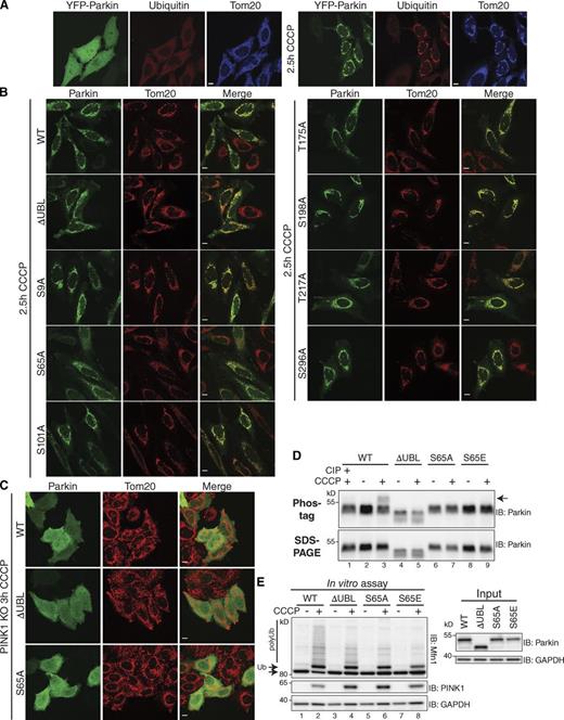 Figure 1. Mutation of conserved serine/threonine residues of Parkin does not completely inhibit Parkin translocation or activity. (A) YFP-Parkin is normally cytosolic (left panels), but upon mitochondrial damage (10 µM CCCP for 2.5 h), YFP-Parkin translocates to mitochondria and causes the ubiquitination proteins (right panels). Cells were stained for Tom20 (mitochondria, blue) and Ub (red). (B) ParkinΔUBL, as well as alanine mutants of Ser/Thr residues previously reported to be phosphorylated, were all capable of translocating to damaged mitochondria (10 µM CCCP for 2.5 h). Fewer cells expressing ParkinS65A displayed mitochondrial translocation than any other mutant (see Table S1). Cells were stained for Parkin (green) and Tom20 (mitochondria, red). For quantification and references of observed phosphorylation, see Table S1. (C) CCCP-treated (10 µM CCCP for 3 h) PINK1 KO cells expressing the indicated Parkin mutants showed that Parkin translocation is PINK1 dependent. (D) Phos-tag and SDS-PAGE gels revealed a shift of WT Parkin on Phos-tag gels after CCCP treatment (arrow), indicating it is phosphorylated (lane 2 vs. lane 3), and this phosphorylation was removed by phosphatase (CIP, lane 1). ParkinΔUBL, S65A, and S65E displayed no observable shift. (E) Parkin in vitro ubiquitination assay revealed that Parkin mutants are capable of ubiquitinating Mfn1 (bottom arrow). Cytosolic extracts from cells expressing the indicated Parkin mutants were incubated with mitochondria from cells not expressing Parkin (±CCCP). Ubiquitination of Mfn1 was observed (arrow + Ub and polyUb) only in the presence of mitochondria from CCCP-treated cells. Bars: (A–C) 10 µm.