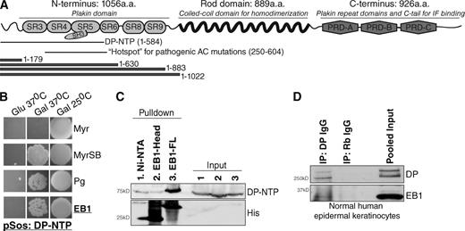 Figure 1. EB1 is a novel binding partner of the DP N terminus. (A) Schematic of DP outlining residues comprising DP-NTP, the DP N-terminal hotspot for pathogenic mutations, and DP N-terminal truncation constructs (see Fig. S1 A). (B) Yeast two-hybrid using DP-NTP as bait. Myr and MyrSB were used as negative and positive controls, respectively, and the known DP-NTP binding partner Pg was used as a positive control. Colony growth on Gal but not Glu plates at 37°C indicates a positive interaction. (C) Pull-down analysis of FLAG-tagged DP-NTP expressed in HEKs with recombinant His-tagged full-length EB1 (EB1-FL), His-tagged EB1 N terminus (residues 1–184), or uncoupled nickel (Ni-NTA) beads. (D) Immunoprecipitation of DP and coimmunoprecipitation of EB1 from NHEKs. Nonspecific rabbit IgG (Rb IgG) was used as a negative control.