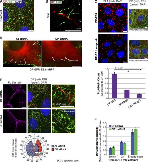 Figure 2. DP regulates spatial organization of EB1. (A and B) Immunolocalization of endogenous DP and EB1 imaged by confocal microscopy (A) and SIM (B). (C) PLA of DP with EB1 in SCC9s (top) and in SCC9s rinsed with saponin detergent to extract cytoplasmic proteins (bottom), with corresponding immunofluorescence. The graph shows quantification of DP-EB1 PLA, or for PLA of each antigen with nonspecific IgG controls (IgG control images not depicted). (D) Single time frames from time-lapse recordings of EB3-mRFP expressed in cells stably expressing DP-GFP. White lines show representative traces of EB3 paths on MTs (see Videos 1 and 2). (E) Immunolocalization of EB1, DP, Pg, and nuclei (DAPI) in Ct or DP KD SCC9s. Radar chart: EB1 comet angles categorized for frequencies between 0 and 90° relative to cell–cell contacts (broken lines, identified by Pg staining; n > 2,400 comets from three independent experiments). (F) Membrane fluorescence intensities of DP during recruitment to cell–cell contacts (calcium switch) and at steady-state in Ct or EB1 KD cells (see Fig. S2, A and B; n = 20 regions of cell–cell contact for each condition, from one of two independent experiments). All data are from SCC9s. Bars, 10 µm (except for the SIM image, in which they are 5 µm). Error bars indicate SEM.