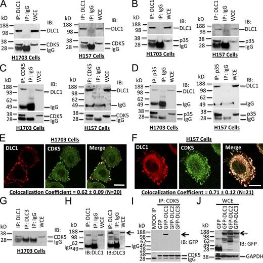 Figure 1. DLC1, CDK5, and its activator p35 form a protein complex in human cell lines. (A) Protein complex between DLC1 and CDK5. Cell lysates were immunoprecipitated (IP) with DLC1 antibody followed by IB with DLC1 (top) or CDK5 (bottom) antibodies. WCE, whole cell extract. H1703 and H157 are NSCLC lines. (B) Protein complex between DLC1 and CDK5 activator p35. Cell lysates were immunoprecipitated with DLC1 antibody followed by IB with DLC1 (top) or p35 (bottom) antibodies. (C) The protein complex between DLC1 and CDK5 was confirmed by reciprocal co-IP. Cell lysates were immunoprecipitated with CDK5 antibody followed by IB with DLC1 (top) or CDK5 (bottom) antibodies. (D) The protein complex between DLC1 and p35 was confirmed by reciprocal co-IP. Cell lysates were immunoprecipitated with p35 antibody followed by IB with DLC1 (top) or p35 (bottom) antibodies. (E) Colocalization of endogenous DLC1 with CDK5 in H1703 cells. Cells were stained with DLC1 (red) and CDK5 (green) antibodies. The colocalization of DLC1 and CDK5 is highlighted in white in the merge image. The images are representative of the majority of cells. An averaged overlapping colocalization coefficient ± SD was calculated from 20 cells randomly selected from several fields, and is shown at the bottom of each panel. (F) Colocalization of endogenous DLC1 with CDK5 in H157 cells. (G–I) CDK5 interacts with DLC1, but not with DLC2 or DLC3. (G) Cell extracts were immunoprecipitated with DLC1 or DLC3 antibodies followed by IB with CDK5 antibody. (H) IP reaction was confirmed by IB with DLC1 or DLC3 antibodies (arrow). (I) Lysates from HEK 293T cells transfected with GFP-tagged DLC1, DLC2, or DLC3 were immunoprecipitated with CDK5 antibody followed by IB with GFP antibody (arrow). (J) Expression of various DLC constructs (arrow) for I. See also Fig. S1. Bars, 20 µm.