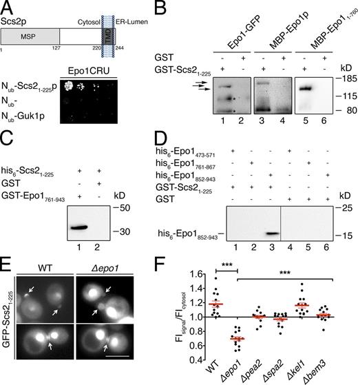 Figure 5. Epo1p binds to two different sites in Scs2p. (A, top) Domain structure of Scs2p. The major sperm domain (MSP) is separated from the C-terminal transmembrane segment (TMD) by a stretch of 93 residues. (bottom) Split-Ub interaction assay as in Fig. 1 B but between Epo1CRU and Nub-Scs21–225 and two Nub fusions that should not interact with Epo1CRU. (B) Eluates of Sepharose bead-coupled GST-Scs21–225 (lanes 1, 3, and 5) or GST (lanes 2, 4, and 6) incubated with yeast extracts containing GFP-tagged Epo1p (lanes 1 and 2) or bacterial extracts containing MBP-Epo1p (lanes 3 and 4) or MBP-Epo11–760 (lanes 5 and 6) were separated by SDS-PAGE. Western blots were probed with anti-GFP (lanes 1 and 2) or anti-MBP antibodies (lanes 3–6). Arrows indicate from top to bottom: MBP-Epo1p, Epo1-GFP, and MBP-Epo11–760. Fragments of Epo1-GFP and MBP-Epo1p running <80 kD and interacting nonspecifically are not depicted. Asterisks indicate proteolytic fragments of Epo1-GFP. (C) As in B but with eluates of Sepharose bead-coupled GST-Epo1761–943 (lane 1) or GST (lane 2) incubated with bacterial extracts containing his6-Scs21–225. The Western blot was probed with anti-His antibodies. (D) As in B, but with eluates of Sepharose bead-coupled GST-Scs21–225 (lanes 1–3) or GST (lanes 4–6) incubated with bacterial extracts containing his6-tagged Epo1473–571 (lanes 1 and 4), Epo1761–867 (lanes 2 and 5), or Epo1852–943 (lanes 3 and 6). The Western blot was probed with anti-His antibodies. The vertical line indicates the removal of a lane loaded with a molecular mass marker. (E) Fluorescence microscopy of WT or Δepo1 cells expressing GFP-Scs21–225 from the PMET17 promoter. Cells were grown in medium containing 70 µM methionine to moderately express the GFP fusion. Top and bottom images show representative yeast cells during polar growth and during cell separation, respectively. Arrows indicate the GFP-Scs21–225 staining at bud tip and bud neck. Bar, 5 µm. (F) Quantification of relative FIs of GFP-Scs21–225 at the bud tips of WT cells and cells lacking the indicated genes (n = 14; error bars show SEM). ***, P < 0.001. The inputs for the experiments in C and D are shown in Fig. S1.