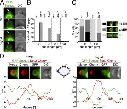 Figure 7. Epo1p links the cER to the bud tip of the cell. (A) Cells containing (top) or lacking (bottom) EPO1 and expressing GFP-Sec62p as the ER marker were analyzed by fluorescence microscopy. Arrows indicate the cortex at the tip of the cells. (B) Regions of absent cER at the bud tip were counted in GFP-Sec62p–expressing WT and Δepo1 cells. Dashed lines separate the results of cells according to the lengths of their buds (22 < n < 144). (C) Effect of EPO1 deletion on cER inheritance. (left) WT and Δepo1 cells expressing GFP-Sec62p were scored for three stages of cER inheritance (no, tubular, or cER) and classified according to the length of their buds (71 < n < 104). (right) Images of Δepo1 cells (top and middle images) and WT cells (bottom image) expressing GFP-Sec62p and Spa2-Cherry exemplifying the three stages of cER inheritance. The same representative images are shown again in Fig. S3 D. (D) The FI profiles at the circumference of the bud were quantified for WT (left, n = 6) and Δepo1 cells (right, n = 15) coexpressing GFP-Sec62p and Spa2-Cherry. (top) Representative image of the inspected WT and inspected Δepo1 cells. (bottom) FIs plotted against the position at the surface of the bud of the two cells shown in the top images. Intensities are given as relative values to the FIs in the cytosol of the mother cell. Bars, 3 µm.