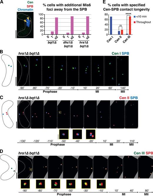 Figure 6. Prophase centromere–SPB contacts in a bqt1Δ setting show a preference for cenIII. (A) In cells with centromere–SPB contacts, additional centromeric foci are observed away from the SPB. Arrowheads mark Mis6-GFP dots far from the SPB during dhc1Δ bqt1Δ prophase. Quantitation is shown to the right. More than 100 cells were scored in five independent experiments. (B–D) Series of frames of films of hrs1Δ bqt1Δ meiosis. Numbering as in Fig 1; the SPB is viewed via endogenously tagged Sad1-CFP. Bars: (black) 5 µm; (gray) 1 µm. (B) The centromere of chromosome I is visualized via a LacI-GFP–bound lys1+-lacO array. (C) The centromere of chromosome II is visualized via a TetR-bound cnt2-tetO array. (D) The centromere of chromosome III was followed via a LacI-bound ade6-lacO array. In these cells, Sad1 is endogenously tagged with mRFP. (E) Collated centromere–SPB interactions. SPB interactions with cenIII are more frequent and longer lasting than those with cenI or cenII; moreover, cenII–SPB interactions are more frequent and longer than cenI–SPB interactions. More than five independent experiments were performed. All cells scored for this figure are more extensively analyzed in Fig. S1 (H–J). ****, P < 0.0001.