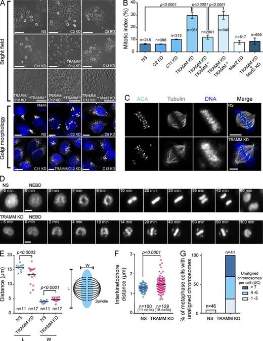 Figure 1. Depletion of TRAMM results in a mitotic arrest as a result of a chromosome congression failure. (A) HeLa cells were photographed by brightfield microscopy at 20× magnification 24 h after treatment with siRNA against the TRAPP subunit indicated or Mad2. In some cases, the cells were cotransfected with siRNA-resistant or -sensitive TRAMM. For simplicity “Trapp” is omitted for each subunit. Depletion was assessed by Golgi morphology using anti–mannosidase II and Western analysis for subunits to which antibodies were available (Fig. S1 A). Bars: (brightfield images) 200 µm; (fluorescence images) 5 µm. (B) Cells from A were quantitated by counting the number of mitotic cells in multiple fields over multiple experiments. Error bars indicate SD. Significance was assessed by an unpaired t test. (C) HeLa cells were fixed 24 h after treatment with nonspecific (NS; top row) or TRAMM/TrappC12-specific (bottom row) siRNA. Staining was performed with antitubulin, ACA, and 7-aminoactinomycin D. Bars, 5 µm. (D) HeLa cells expressing fluorescently labeled histone H2B were treated with NS (top row) or TRAMM/TrappC12-specific (bottom row) siRNA. The cells shown were recorded 20 h after treatment. Frames from Videos 1 and 2 were captured, and times indicated are relative to nuclear envelope breakdown (NEBD). Bars, 10 µm. (E–G) Measurements of chromosome boundary dimensions (E), interkinetochore distances (F), and unaligned chromosomes (G) were made after treatment of HeLa cells as in A. Chromosome boundary length (L) and width (W) were measured between the spindle poles and perpendicular to the poles, respectively. Results are shown ± SD, and significance was assessed by an unpaired t test. KD, knockdown.