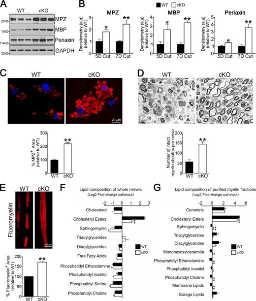Figure 4. Genetic inactivation of autophagy retards myelin degradation in vivo. (A) Western blot showing higher levels of the myelin proteins MPZ, MBP, and Periaxin in 5 d cut nerves from Atg7 cKO mice compared with WT controls. (B) Densitometric analysis of Western blots showing higher levels of myelin proteins in 5 and 7 d cut nerves from Atg7 cKO mice compared with WT controls. For each comparison, the value for cKO is normalized to that seen in WT. n = a minimum of three mice for the genotype/time point. Data are presented as mean ± SEM (error bars). *, P < 0.05; **, P < 0.01 (Atg7 cKO relative to WT). (C) Immunolabeling showing MPZ+ myelin inclusions in cultured WT Schwann cells and cells from Atg7 cKO nerves that often show bloated “cauliflower” morphology. The graph shows quantification of MPZ+ area. Data are presented as mean ± SEM (error bars) from three independent experiments with a minimum of 60 cells analyzed per condition. **, P < 0.01 (Atg7 cKO relative to WT). (D) Electron micrographs showing several intact myelin sheath profiles in 5 d cut nerves from Atg7 cKO mice. The graph shows a quantification of the number of intact myelin sheaths. Data are presented as mean ± SEM (error bars) from three independent experiments with a minimum of 18 picture frames analyzed per condition/experiment. **, P < 0.01 (Atg7 cKO relative to WT). (E) Teased fibers of 5 d cut nerves from WT and Atg7 cKO mice stained with FluoroMyelin red to show myelin. The graph shows a quantification of the myelin fluorescent area. Data are presented as mean ± SEM (error bars) from three independent experiments with a minimum of 10 picture frames analyzed per condition/experiment. **, P < 0.01 (Atg7 cKO relative to WT). (F) The lipid composition of whole sciatic nerves from 5 d cut WT and Atg7 cKO mice expressed as log2 fold change compared with uncut nerves. n = a minimum of four mice for each genotype. Data are presented as mean ± SEM (error bars). **, P < 0.01. (G) The lipid composition of purified myelin obtained from sciatic nerves from 5 d cut WT and Atg7 cKO mice, expressed as log2 fold change compared with uncut nerves. The individual lipid species detected by UPLC were grouped in distinct lipid classes as shown in the graph. “Membrane lipids” refers to all lipid species detected that are the major structural lipids in the eukaryotic membrane, including phosphatidylethanolamines, phosphatidylcholines, and phosphatidylinositols, and “storage lipids” include triacylglycerides and cholesteryl esters. See Table S2 for changes in levels of individual lipid species in WT and Atg7 cKO mice. n = 3 mice for each genotype. Data are presented as mean ± SEM (error bars). *, P < 0.05; **, P < 0.01 (Atg7 cKO relative to WT).