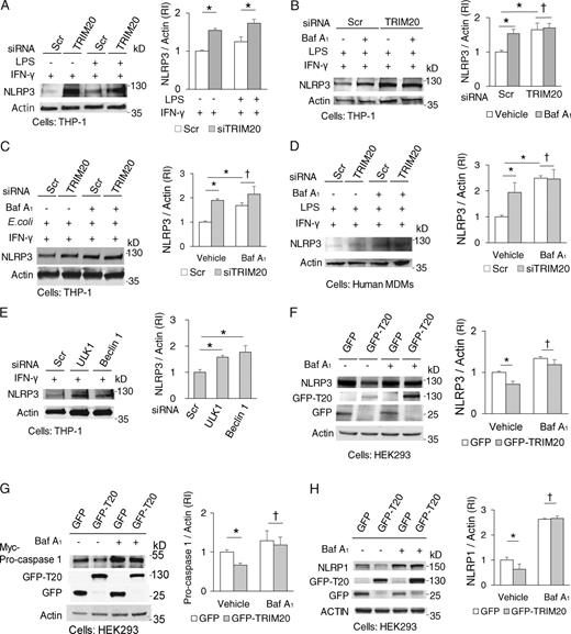 Figure 5. TRIM20 degrades inflammasome components through autophagy. (A) Levels of NLRP3 were determine in lysates from THP-1 cells subjected to TRIM20 or scrambled (Scr) siRNA were activated with 1,000 U/ml IFN-γ for 3 h, and 2.5 µg/ml LPS for 2 h (for optimal TRIM20 expression; Fig. S3 B). RI, relative intensity. (B) Levels of NLRP3 were determined in THP-1 subjected to TRIM20 or control knockdowns and treated or not with bafilomycin A1 (Baf A1). (C) The abundance of NLRP3 protein was determined in THP-1 cells subjected to TRIM20 or control knockdowns and exposed to Escherichia coli strain LF82 and IFN-γ in the presence or absence of bafilomycin A1. (D) The abundance of NLRP3 protein was determined in primary human MDMs subjected to TRIM20 or control knockdowns and exposed to LPS and IFN-γ in the presence or absence of bafilomycin A1. (E) Levels of NLRP3 were determined in THP-1 cells subjected to ULK1, Beclin 1, or scrambled (Scr) siRNA and treated with IFN-γ and LPS. (F–H) Levels of NLRP3 (F), NLRP1 (G), or pro–caspase 1 (H) were determined in cells expressing GFP or GFP-TRIM20 after autophagy induction (Earle's balanced salt solution , 3 h) in the presence or absence of bafilomycin A1. Data, means ± SE; n ≥ 3. *, P < 0.05; †, P ≥ 0.05 (ANOVA).