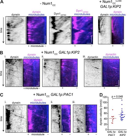 Figure 7. Direct observation of Num1CC-mediated minus end motility of dynein and dynactin. (A) Example kymographs of plus end–directed motility of dynein molecules along astral microtubules observed in uninduced GAL1p:num1CC cells (left; –Num1CC) or in cells overexpressing Num1CCLL/EE and Kip2 (right). (B and C) Example kymographs depicting minus end–directed motility of dynein or dynactin (i.e., Jnm1) along astral microtubules in cells overexpressing Num1CC and either Kip2 (B) or Pac1 (C). Kymographs were generated from time-lapse images acquired using highly inclined and laminated optical sheet microscopy (see Materials and methods). Bars: (vertical) 1 min; (horizontal) 1 µm. (D) Velocity values for minus end–directed dynein runs observed in either Pac1- or Kip2-overexpressing cells. See also Fig. S5 and Videos 2 and 3.