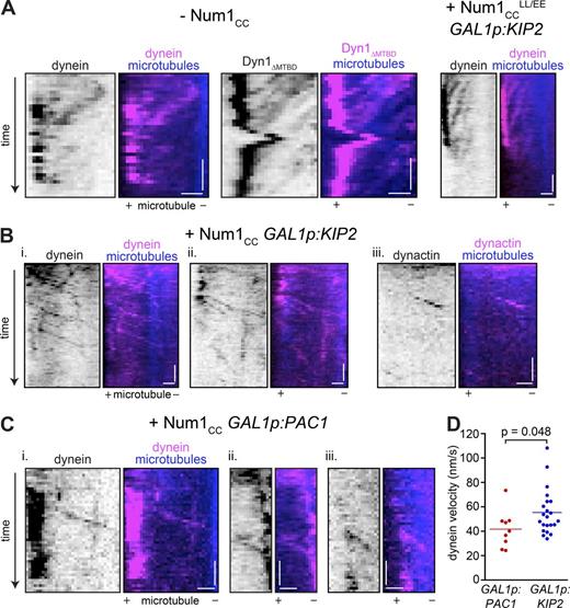 Figure 7. Direct observation of Num1CC-mediated minus end motility of dynein and dynactin. (A) Example kymographs of plus end–directed motility of dynein molecules along astral microtubules observed in uninduced GAL1p:num1CC cells (left; –Num1CC) or in cells overexpressing Num1CCLL/EE and Kip2 (right). (B and C) Example kymographs depicting minus end–directed motility of dynein or dynactin (i.e., Jnm1) along astral microtubules in cells overexpressing Num1CC and either Kip2 (B) or Pac1 (C). Kymographs were generated from time-lapse images acquired using highly inclined and laminated optical sheet microscopy (see Materials and methods). Bars: (vertical) 1 min; (horizontal) 1 µm. (D) Velocity values for minus end–directed dynein runs observed in either Pac1- or Kip2-overexpressing cells. See also Fig. S5 and Videos 2 and 3.